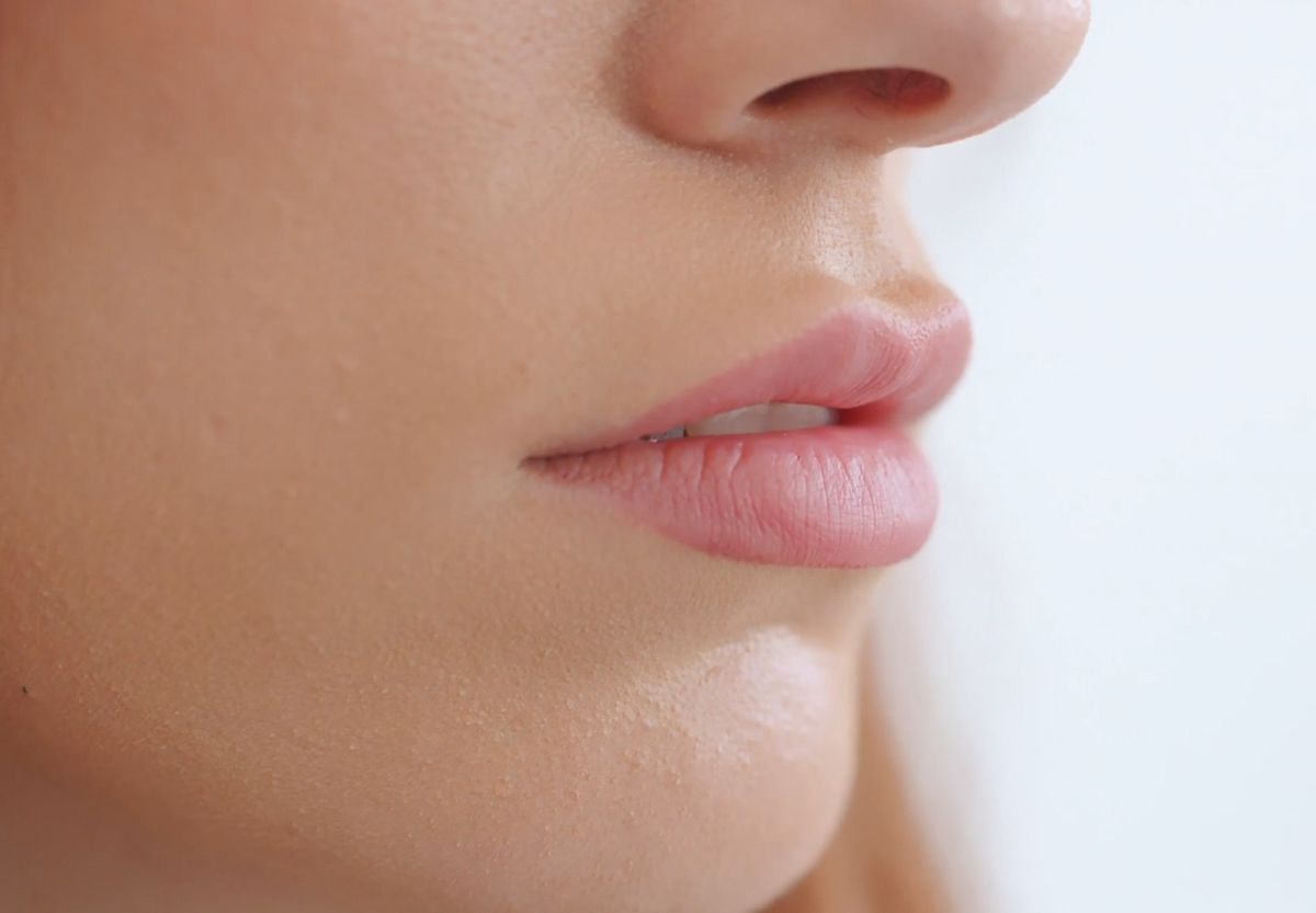 dermal filler after procedure modesto ca