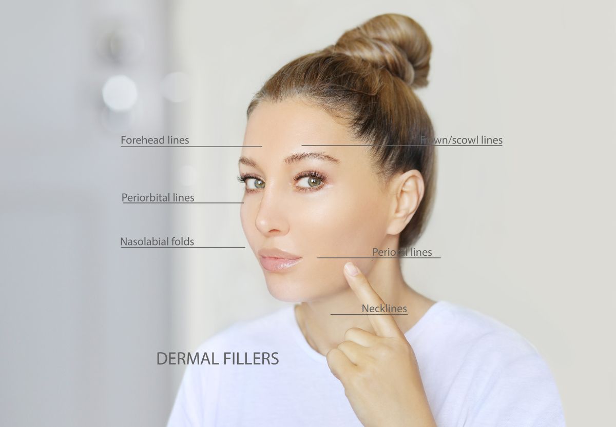 dermal filler types