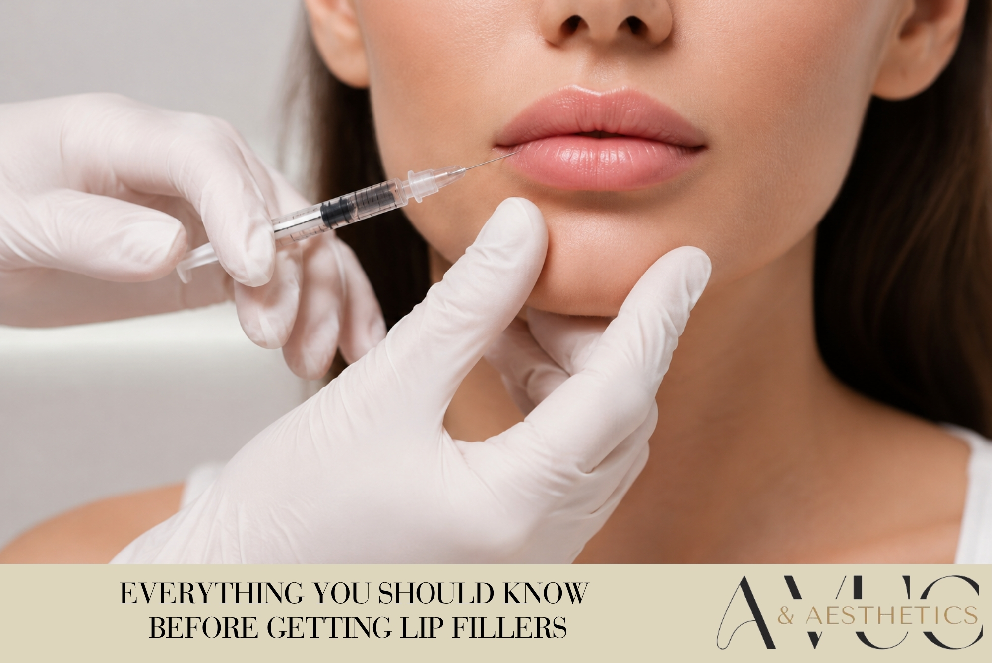 Everything You Should Know Before Getting Lip Fillers