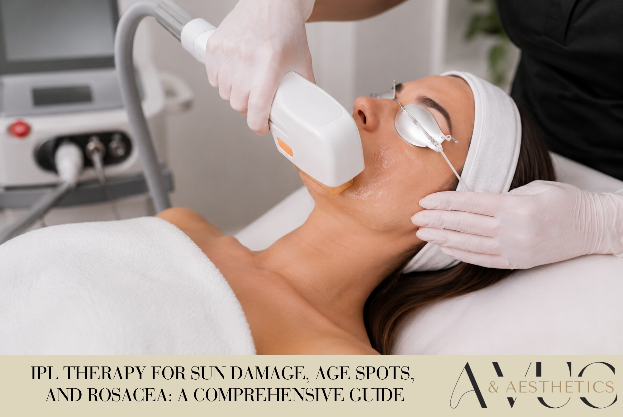 IPL Therapy for Sun Damage, Age Spots, and Rosacea: A Comprehensive Guide