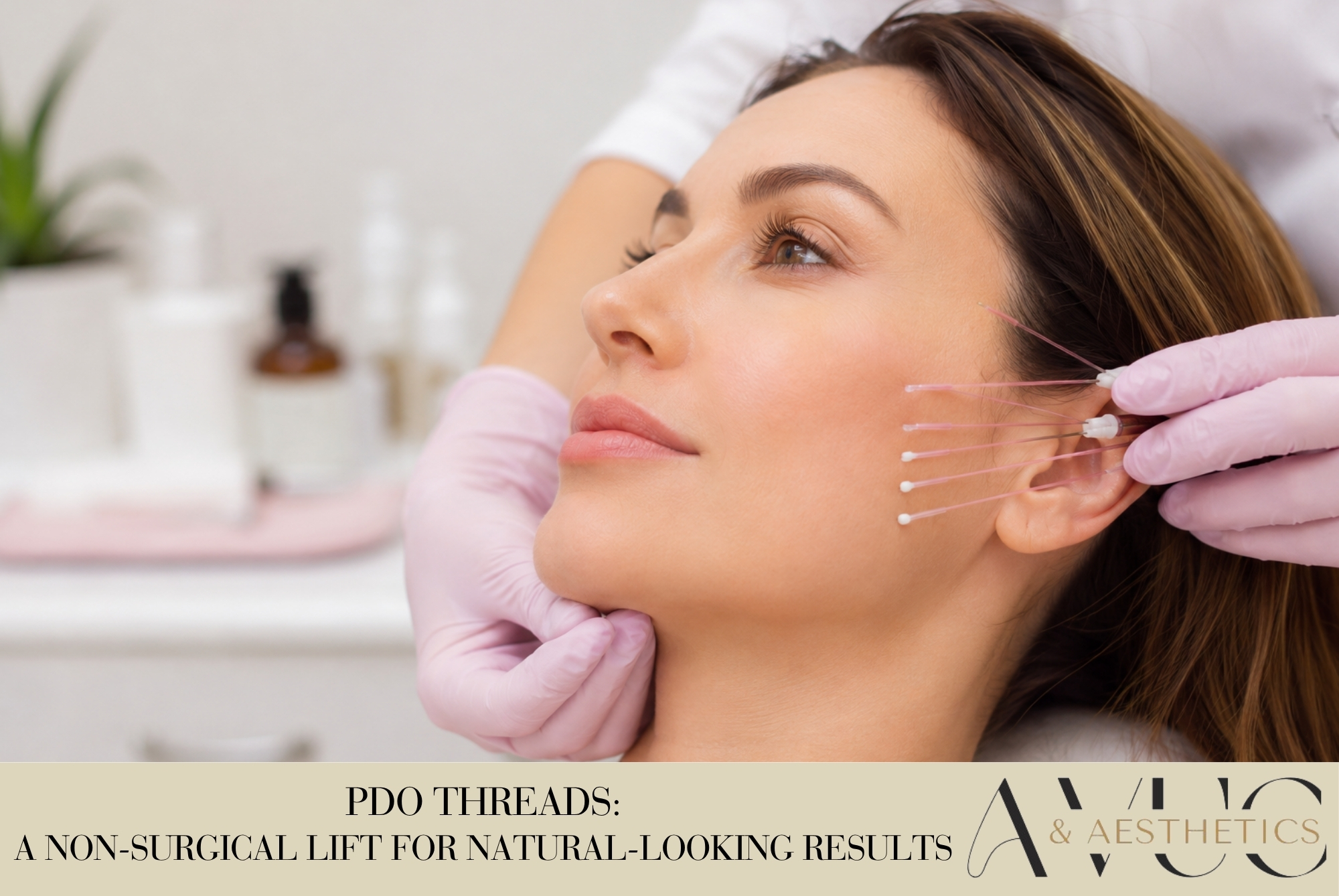 PDO Threads: A Non-Surgical Lift for Natural-Looking Results